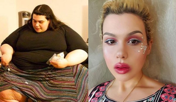 Девушка, которая весила 300 кг, похудела и превратилась в красавицу